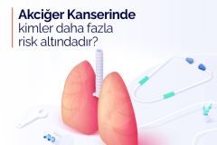 Akciğer Kanserinde Kimler Daha Fazla Risk Altındadır?